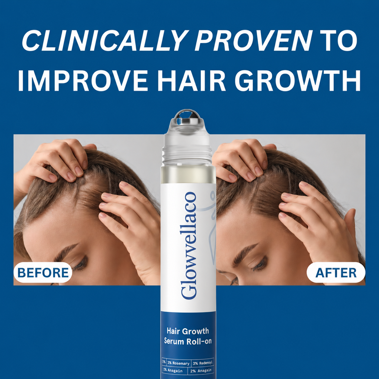 Glowvellaco Hair Growth Roll On Serum