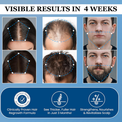Glowvellaco Hair Growth Roll On Serum