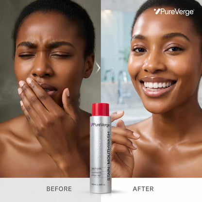 PureVerge® Stain Whitening Mouthwash