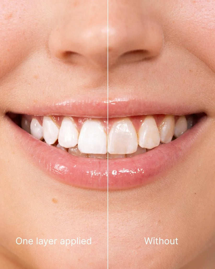 Glowvellaco® Tooth Polish - Instant White Smile