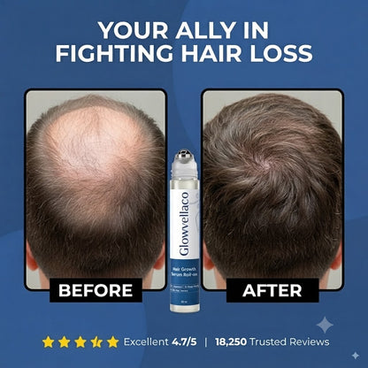 Glowvellaco Hair Growth Roll On Serum